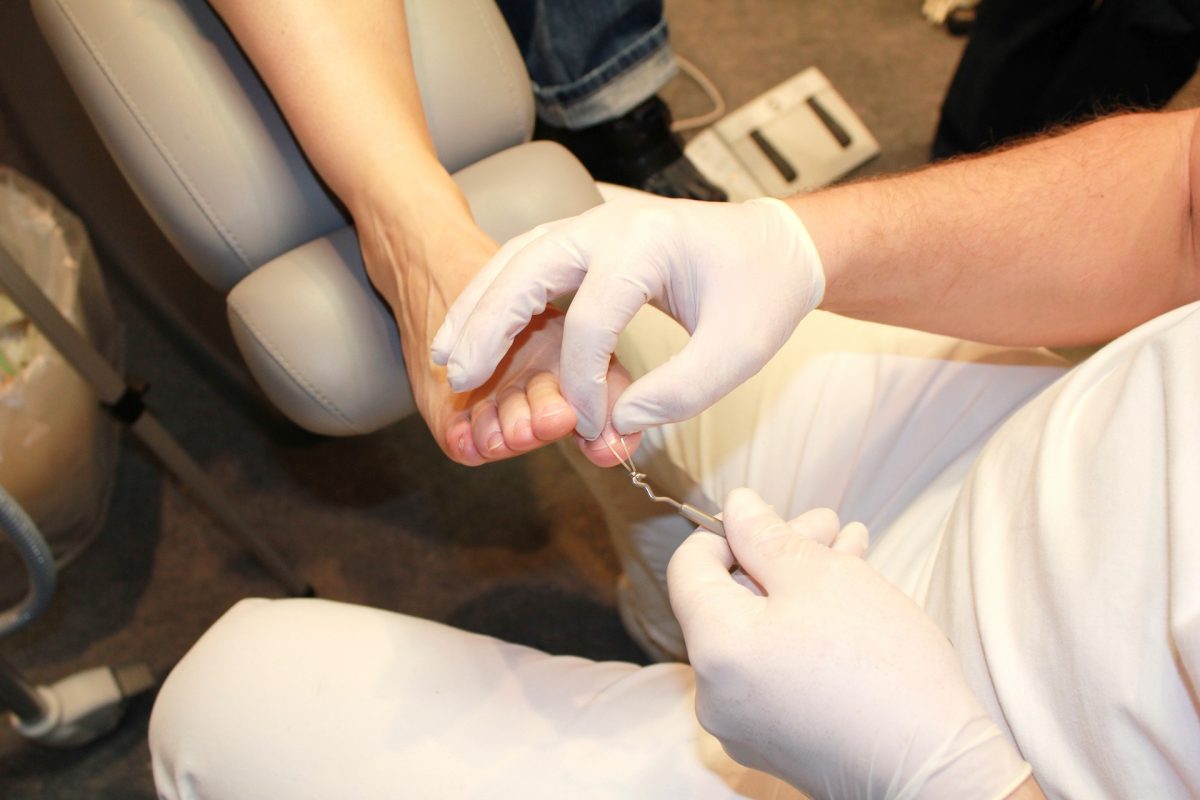Four Reasons Why You Should See A Podiatrist Cleveland