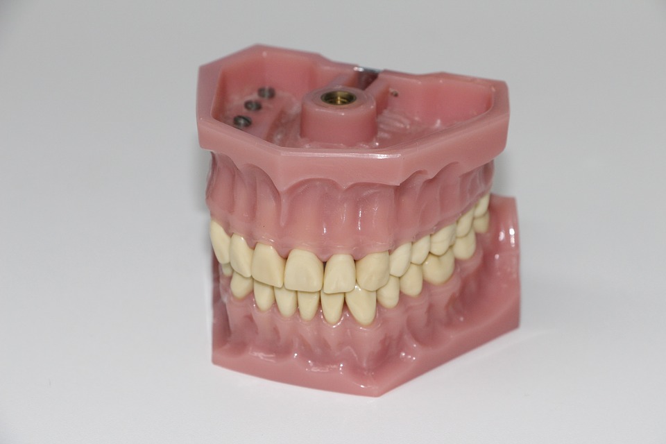 Partial Dentures Brisbane North For You