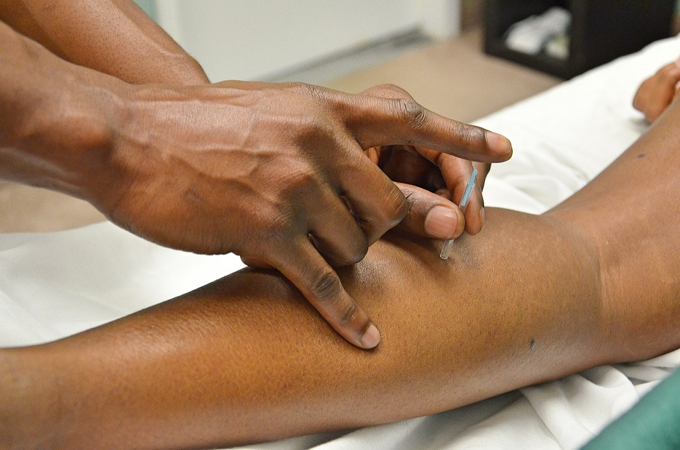 Is Acupuncture Painful? Demystifying The General Beliefs