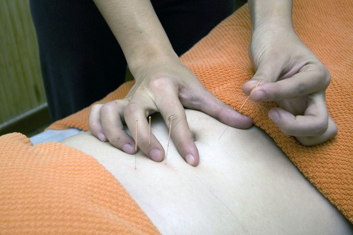 Does Acupuncture For Fertility Work?