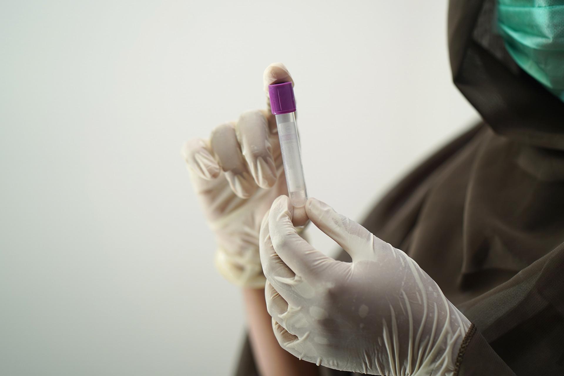 blood-test-5601437_1920 (2)