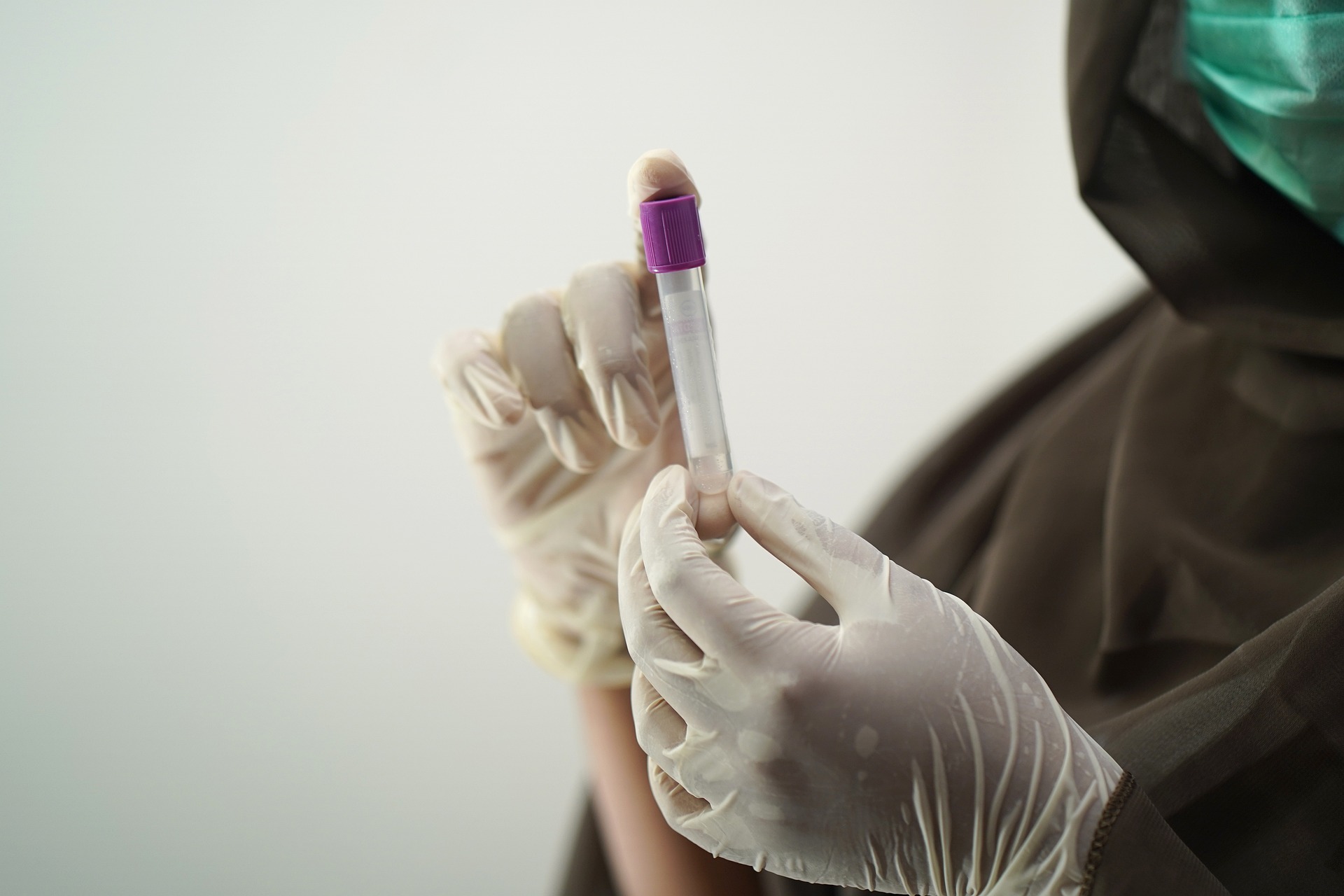 blood-test-5601437_1920 (3)